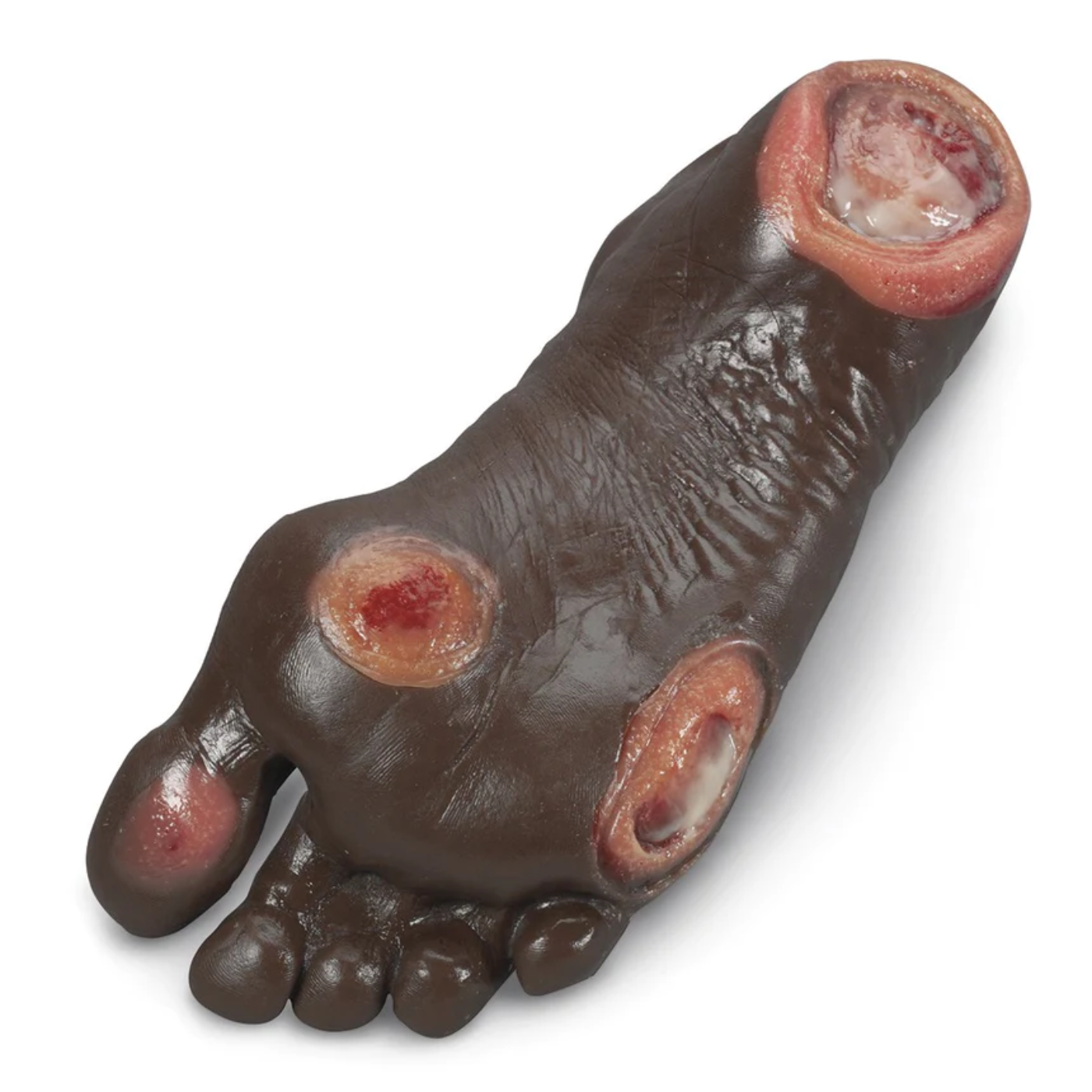 Elderly Pressure Ulcer Foot - Dark - Nasco